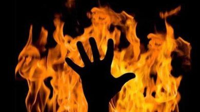 Man burnt sister-in-law, held