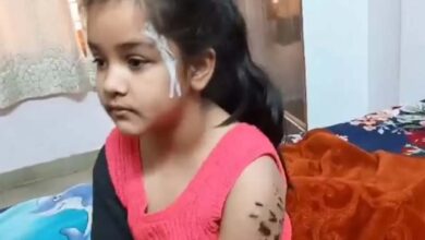 Delhi News: 7 year old girl suffered more than 15 injuries in the attack by American bully dog in Rohini