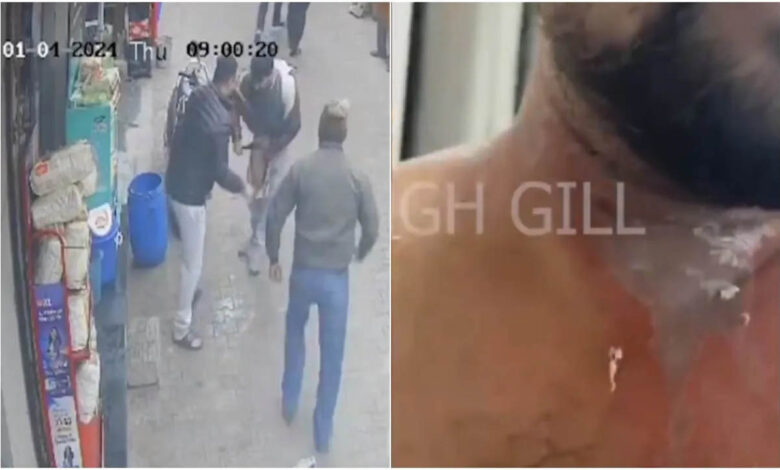 Miscreants threw acid on the shopkeeper, watch LIVE VIDEO of the young man in agony