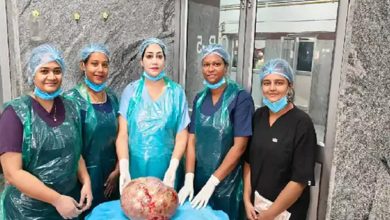 Woman's life saved by removing 10kg tumor from stomach, successful operation in Sims