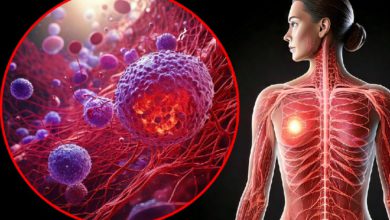 Study finds risk-based approach to breast cancer screening is better